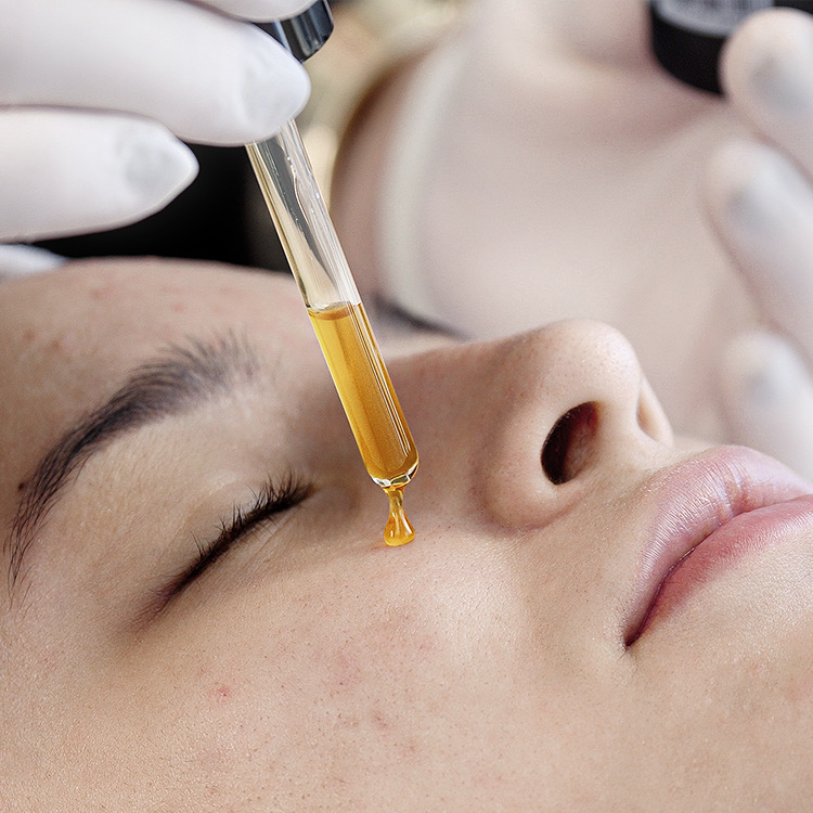 Foto 4 do BLACK SECRET PEELING ANTIACNE 30ML